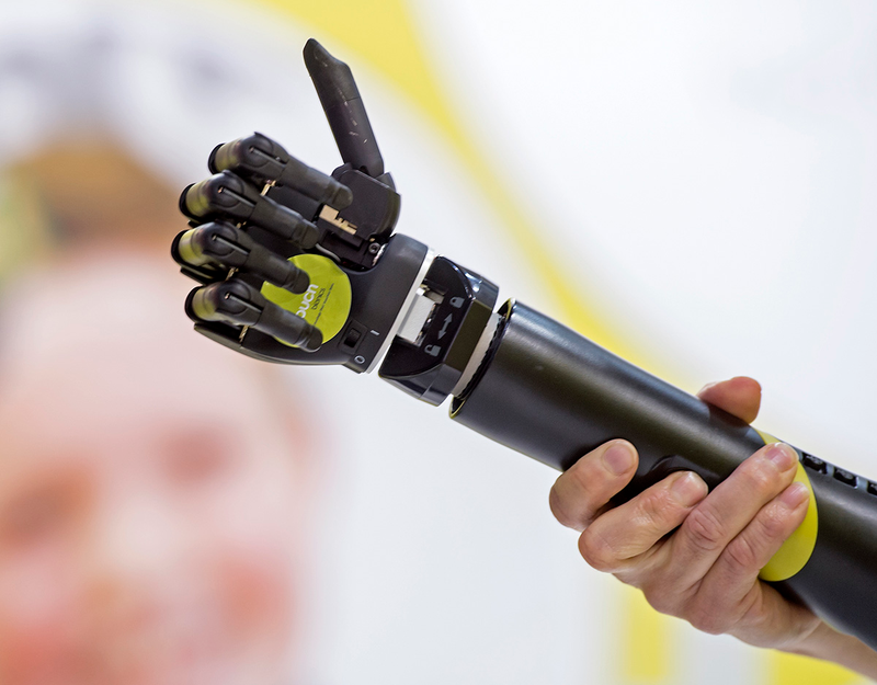 A man presents the bionic âi-limb quantumâ prosthesis from Touch Bionics. Image: Jens Meyer/AP